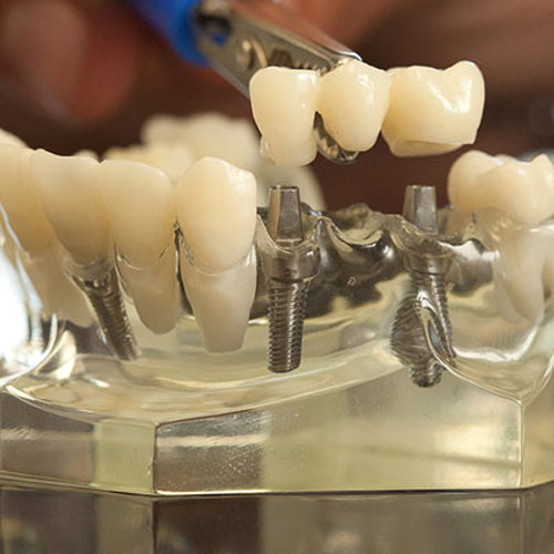Mullins Sc Dental Impant Dentistry