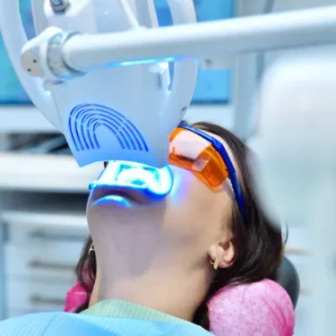 The Benefits of Professional Teeth Whitening in Mullins, SC